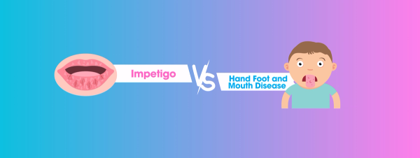 Impetigo vs Hand Foot and Mouth Disease