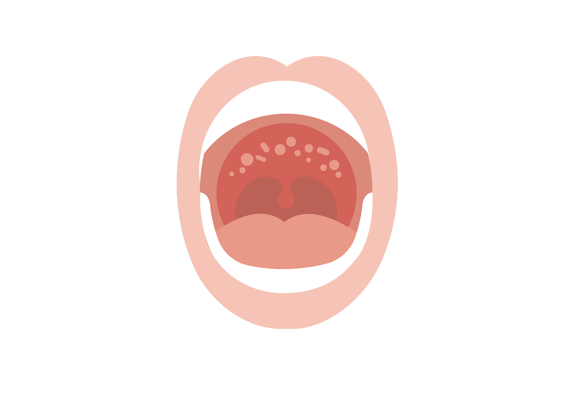 The Secret Pain in Your Roof of Mouth No One Talks About