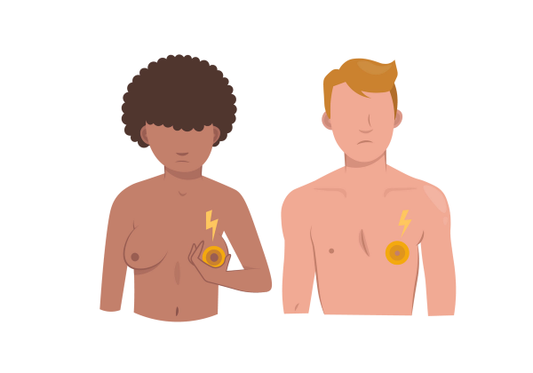 A man and a woman stand next to each other frowning. The woman on the left holds her left breast which emanates yellow concentric circles and a yellow lightning bolt. The man on the right has the same circles and lightning bolt on his left nipple.