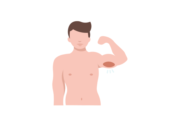 An illustration of a man with an arm raised and his triceps highlighted in red to show pain. The man is not wearing a shirt and has brown short hair.