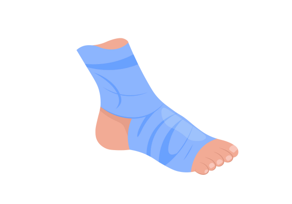 An illustration of a foot and ankle with light peach-toned skin. The ankle and foot are wrapped in a light blue ace bandage. The toenails are a lighter shade of peach.