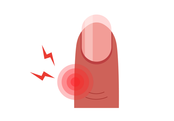 An illustration of a fingertip with a spot of red concentric circles showing pain. Two red lightning bolts come from the spot. The finger is a medium-dark peach tone with a lighter pink fingernail with a french manicure.