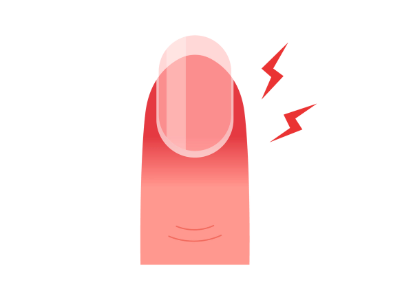 An illustration of a fingertip and nail. The skin at the tip of the finger is dark red and fades to a lighter pink closer to the knuckle. Two red lightning bolts come from the fingernail on the right side.