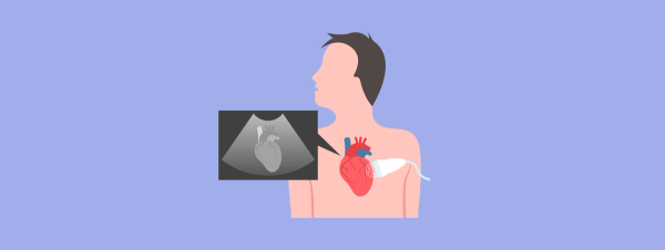 Elevated Testosterone Linked to Higher Atrial Fibrillation Risk in Older Men