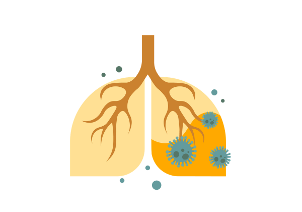 Lungs with inflammation on one side.