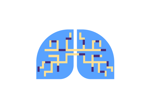 Lungs with clots blocking blood flow