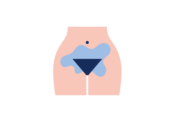 A woman's hips and upper thighs. There is a dark blue inverted triangle over her pelvis and a light blue blob surrounds it.