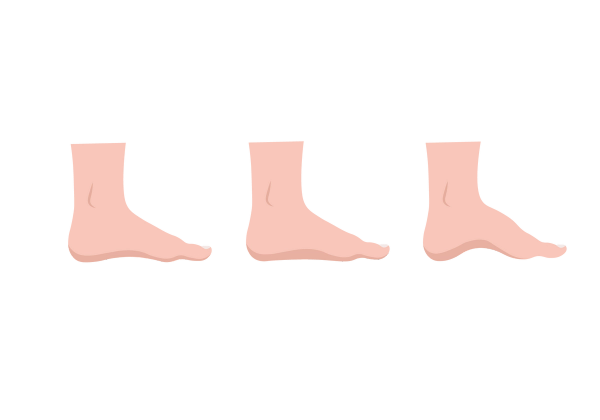 An illustration of three light peach-toned feet from side views, all with toes pointing right. The first one has a typical profile, the second has a lower sitting arch, and the third shows a high arch.