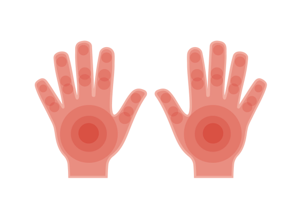 Two hands with red concentric circles emanating from the palms and knuckles.