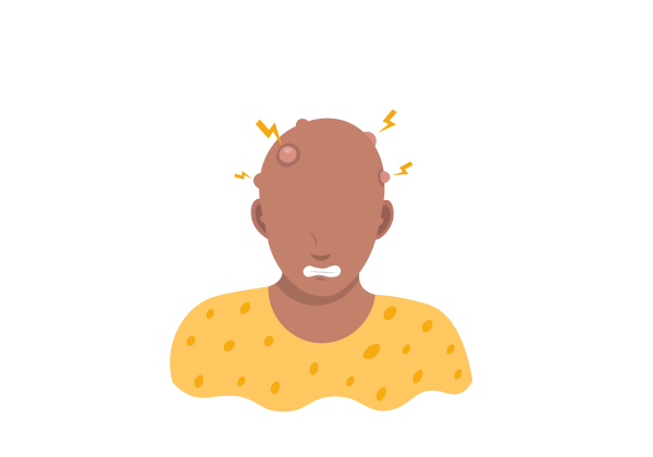 An illustration of a grimacing person with no hair and many bumps on the scalp. Yellow lightning bolts emanate from the bumps. The person is wearing a yellow spotted t-shirt.