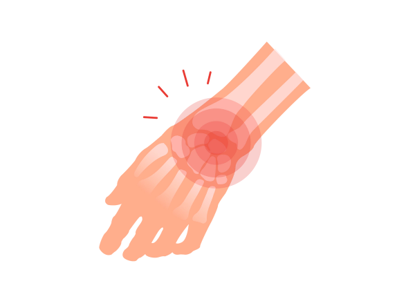 An illustration of a relaxed hand. The bones are visible in the wrist and top of the hand. Red concentric circles and four red lines emanate from the wrist.