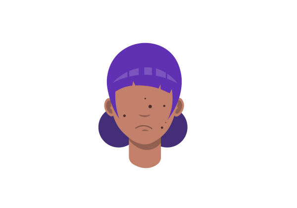 An illustration of a girl from the neck up. She has medium-dark peach-toned skin with dark brown round circles speckling her frowning face. Her purple hair is cut into messy bangs and fringe and is tied in two low buns on the back of her head.