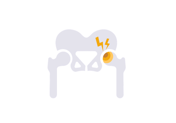 A hip with pain bolts on the greater trochanteric area.