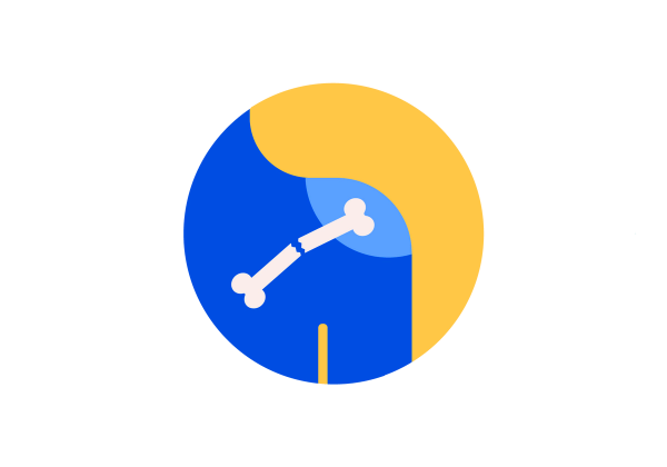 Blue shoulder with a broken white bone inside of it within a yellow circle.