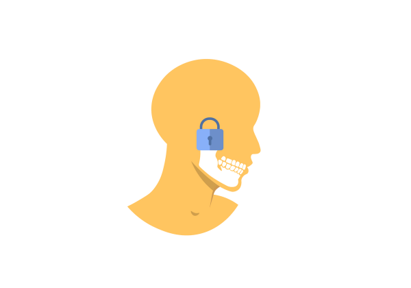 An illustration of a side profile of a person's head. The jaw bone and teeth are white and visible over the yellow skin. A lock sits at the jaw joint.