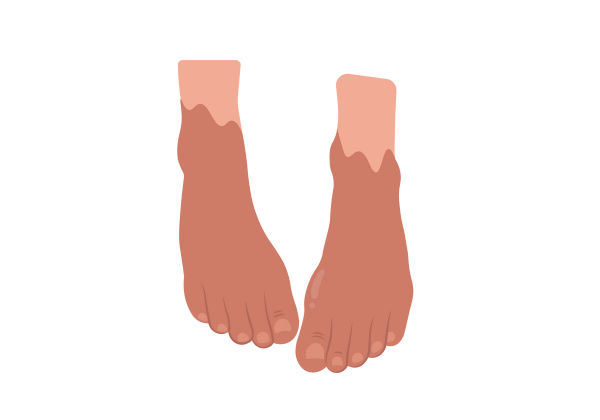 An illustration of two feet from a partial top-down view. The ankles are light peach-tone, and the feet are a darker shade of peachy-red.