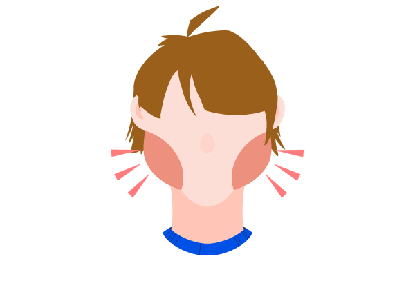 An illustration of a little boy from the neck up. His cheeks are bright red and swollen. Three bright red triangles come from his cheeks on each side to emphasize the swelling. The boy has otherwise light peach skin and medium brown short messy hair. The collar of his shirt is dark blue.