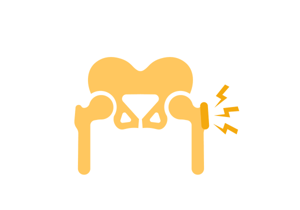 Yellow skeletal view of the hips and pelvis, with an orange spot on the right bursa sac. Three orange lightning bolts emanate from the spot.