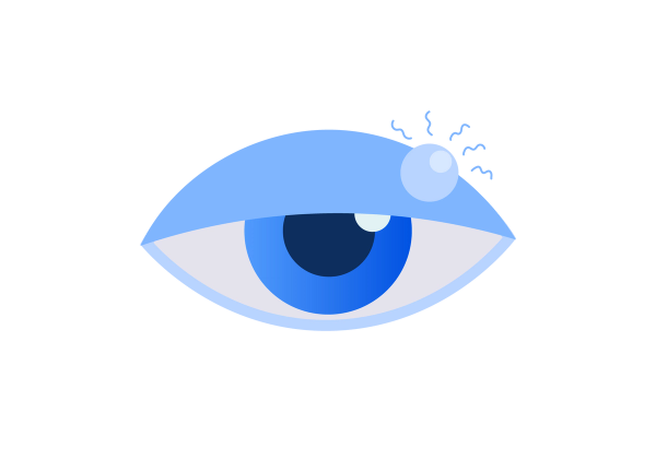 An illustration of an eye with a half closed light blue eyelid. A lighter blue lump is on the right of the eyelid. Five blue squiggles emanate from the lump. The iris is medium blue and the pupil is dark blue.