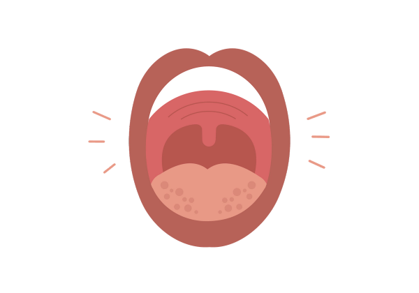 A swollen mouth that is opened.