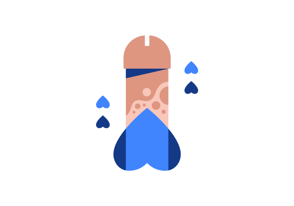 An illustration of an upright penis and scrotum. The penis is patchy and discolored a darker pink. The scrotum is dark blue. There are two sets of upside down blue hearts on either side of the penis.