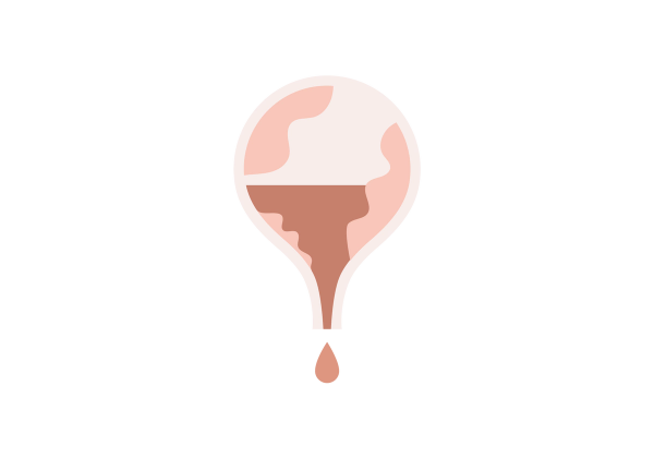 An illustration of a light pink bladder with red inside of it. A red drop drips from the bottom.