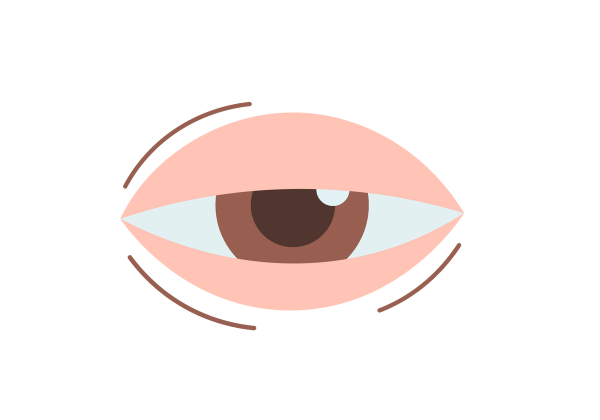 An illustration of an eye with the eyelids covering the top and bottom third of the eye. The iris is brown and the pupil is dark brown. Three brown lines surround the edges of the eyelid.