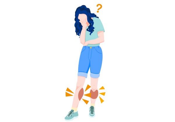 An illustration of a woman with her hand on her chin looking confused at her swollen calves. The leg on the left is stuck out in front of her for her to examine, and red spots spread across her calves. Yellow triangles emphasize the swollen areas. A yellow question mark is next to her head. She has long curly dark blue hair and is wearing a light green t-shirt tucked into cuffed jean short with yellow socks and green sneakers.