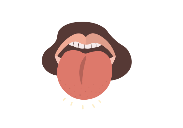 An illustration of an open mouth with a large, swollen, red tongue sticking out. A brown shape surrounds the lips representing facial hair.