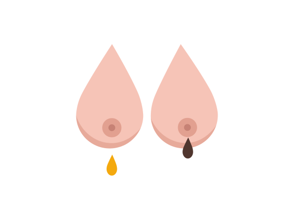 Two teardrop-shaped breasts. The left one is dripping a yellow drop, the right one is dripping a brown drop.