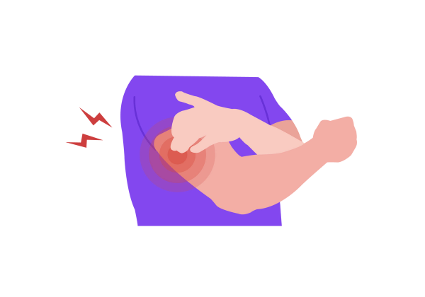 An illustration of a man's torso and arms from a three quarter view facing slightly right. He is touching a spot on his right arm with his left hand. The spot is a red circle with three red translucent circles coming from it, and two red lightning bolts come from it as well. He has light peach-toned skin and is wearing a short-sleeved purple shirt.