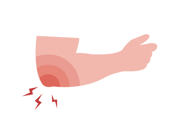 A bent arm. Red emanates from the elbow, along with three red lightning bolts.