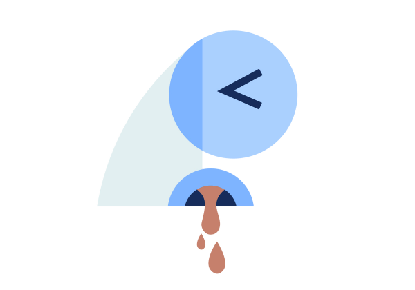 An illustration of a light green and blue nose from the side. The eye is squeezed shut in distress. Red blood drips from the nostril.