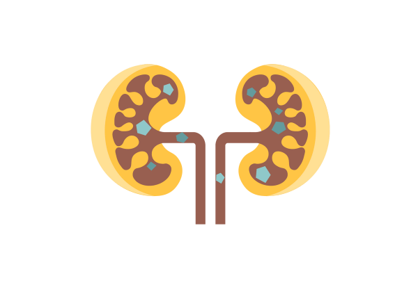 Two yellow kidneys with brown shapes running through them. Blue and green pentagons dot the brown canals.