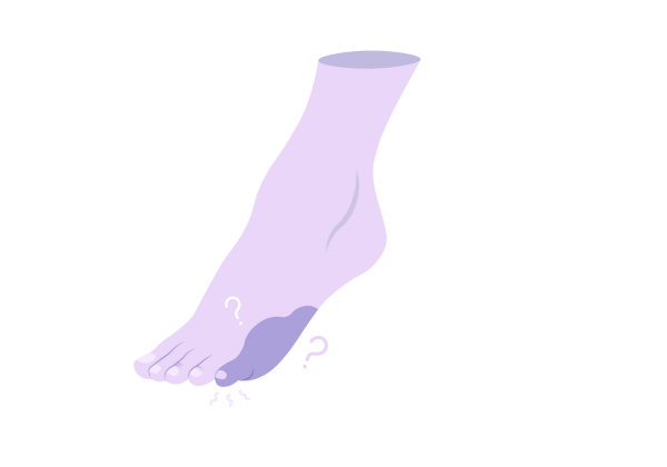 An illustration of a light purple foot facing left. The pinky toe has a darker purple splotch surrounding it. Two light purple question marks and three squiggles are around the pinky toe.