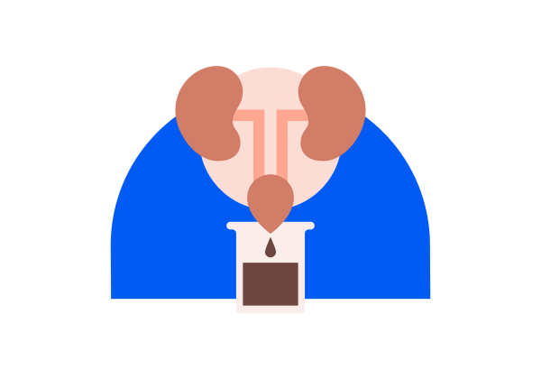 An illustration of a set of darker red kidneys connected by lighter red tubes to a darker red bladder. Coming out of it is a drop of dark brown urine into a sample cup halfway full of dark brown urine. A blue arch is the background.