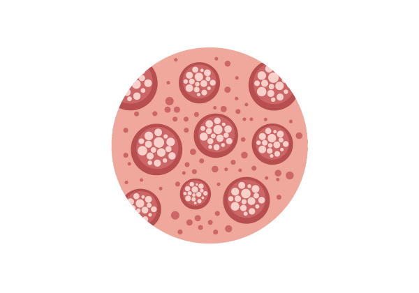 A pink circle with smaller dark pink circles inside. Each of the dark pink circles is filled with smaller white dots, and dark pink dots speckle the areas between these circles.