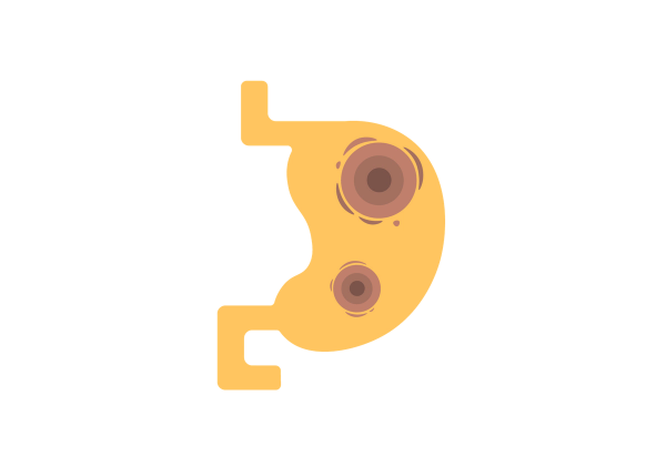 Yellow stomach with two sets of brown concentric circles inside.