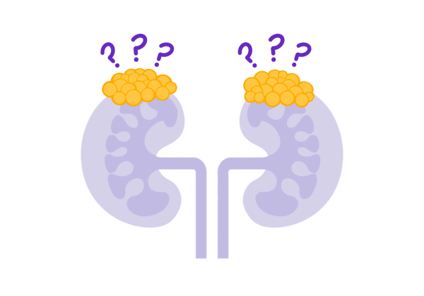 An illustration of two purple kidneys with bright yellow adrenal glands. There are three dark purple question marks over each adrenal gland.