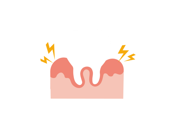 An illustration of a white tooth embedded in a light pink gum with darker pink splotches towards the surface. Two yellow lightning bolts come from the red splotches on the gum on each side of the tooth.